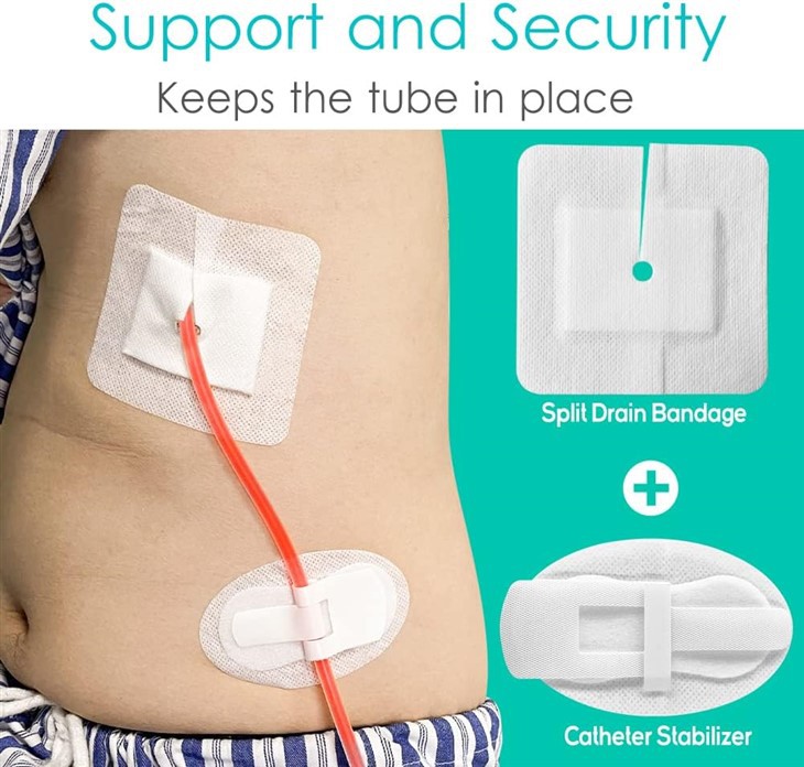 Kviðskilun PD Catheter Drain Split Bordered Grisja